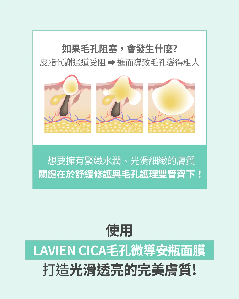 [保養團] 7/1~7/31 皮膚遇到停滯期了嗎? 找到代替水光針的保養品 樂薇昂 LAVIEN（照片 7）