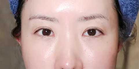 [保養團] 7/1~7/31 皮膚遇到停滯期了嗎? 找到代替水光針的保養品 樂薇昂 LAVIEN（照片 74）