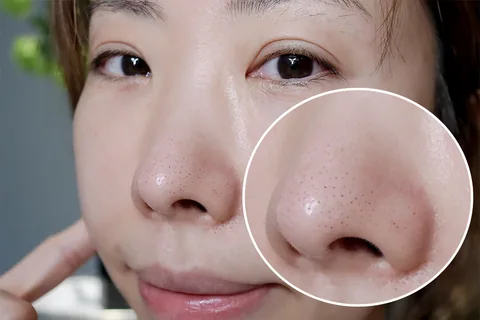 [面膜] 7/1~7/31 困擾黑頭粉刺，大毛孔 如何去除收斂毛孔計畫在樂薇昂 LAVIEN（照片 59）