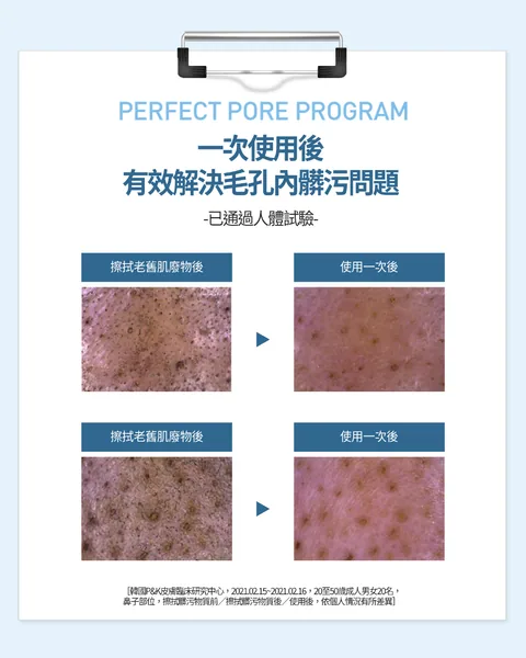 [面膜] 7/1~7/31 困擾黑頭粉刺，大毛孔 如何去除收斂毛孔計畫在樂薇昂 LAVIEN（照片 102）