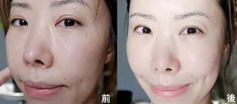 [面膜] 7/1~7/31 困擾黑頭粉刺，大毛孔 如何去除收斂毛孔計畫在樂薇昂 LAVIEN（照片 133）