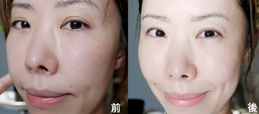 [面膜] 7/1~7/31 困擾黑頭粉刺，大毛孔 如何去除收斂毛孔計畫在樂薇昂 LAVIEN（照片 133）