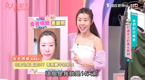 [團購美容儀] 11/19~12/19 家用1台Ulike超光炮，勝過2台醫美黑金光子DPL+NIR 雙效美肌的全新選擇！(獎)（照片 5）