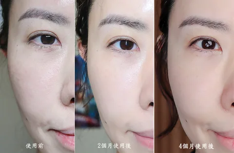[團購美容儀] 11/19~12/19 Ulike 白皇后來了！🔥 黑卡級護膚神器，讓你素顏比化妝還美！限時團購中！(獎)（照片 8）
