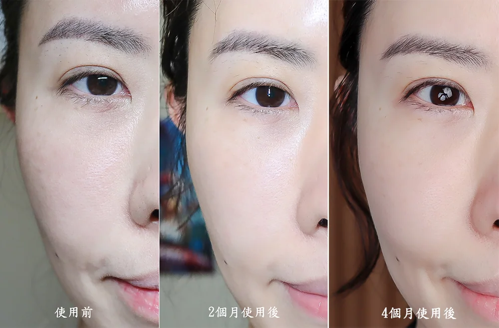 [團購美容儀] 11/19~12/19 Ulike 白皇后來了！🔥 黑卡級護膚神器，讓你素顏比化妝還美！限時團購中！(獎)（照片 8）