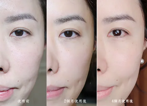 [團購美容儀] 11/19~12/19 Ulike 白皇后來了！🔥 黑卡級護膚神器，讓你素顏比化妝還美！限時團購中！(獎)（照片 13）