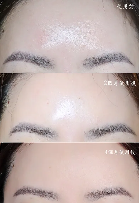 [團購美容儀] 11/19~12/19 Ulike 白皇后來了！🔥 黑卡級護膚神器，讓你素顏比化妝還美！限時團購中！(獎)（照片 37）