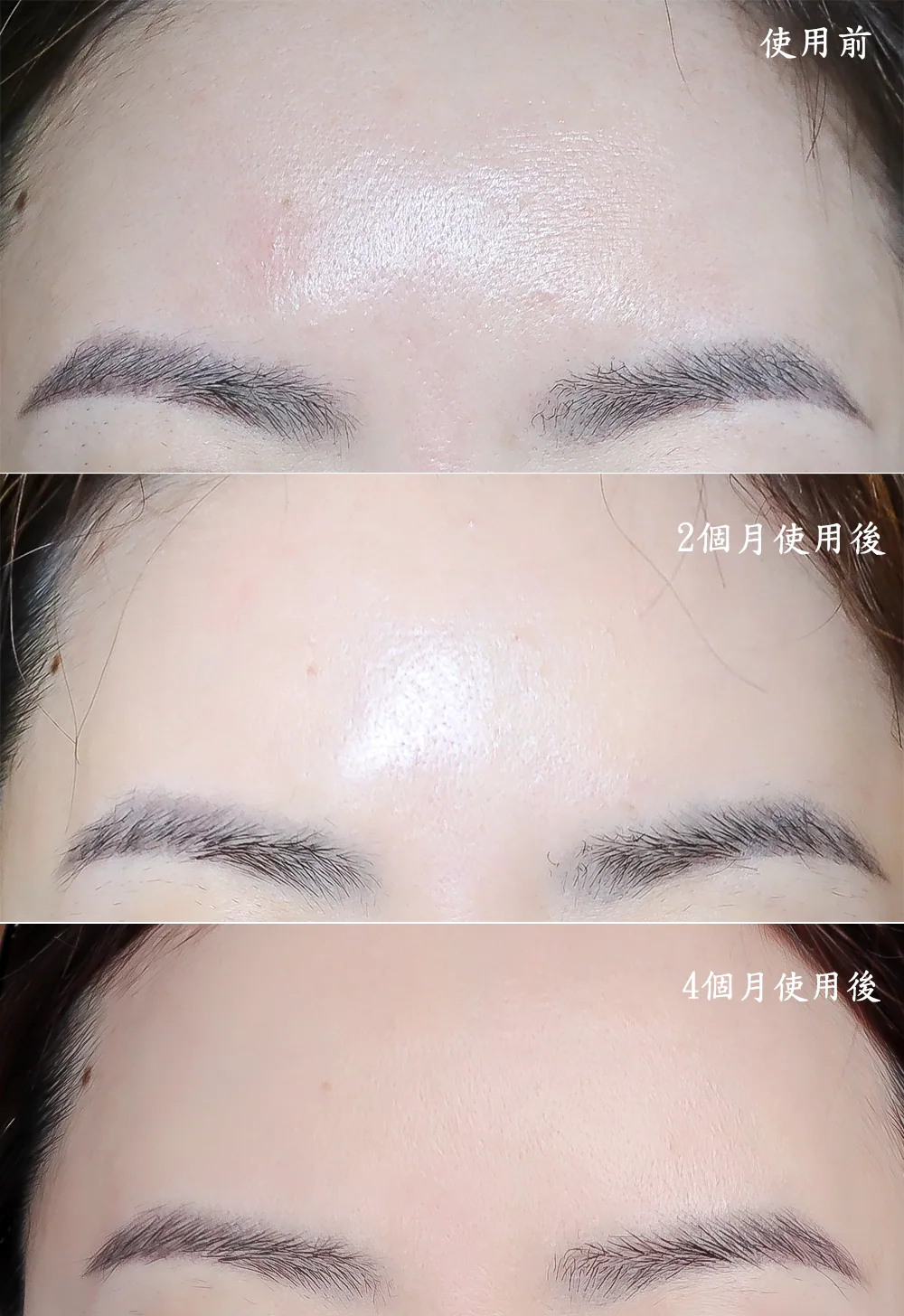 [團購美容儀] 11/19~12/19 Ulike 白皇后來了！🔥 黑卡級護膚神器，讓你素顏比化妝還美！限時團購中！(獎)（照片 37）