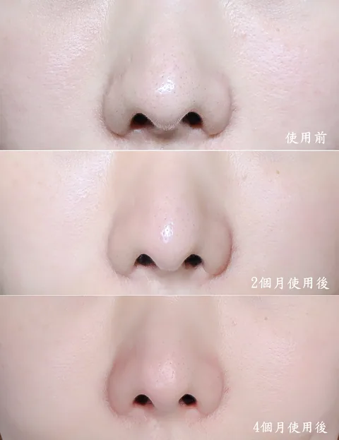 [團購美容儀] 11/19~12/19 Ulike 白皇后來了！🔥 黑卡級護膚神器，讓你素顏比化妝還美！限時團購中！(獎)（照片 38）