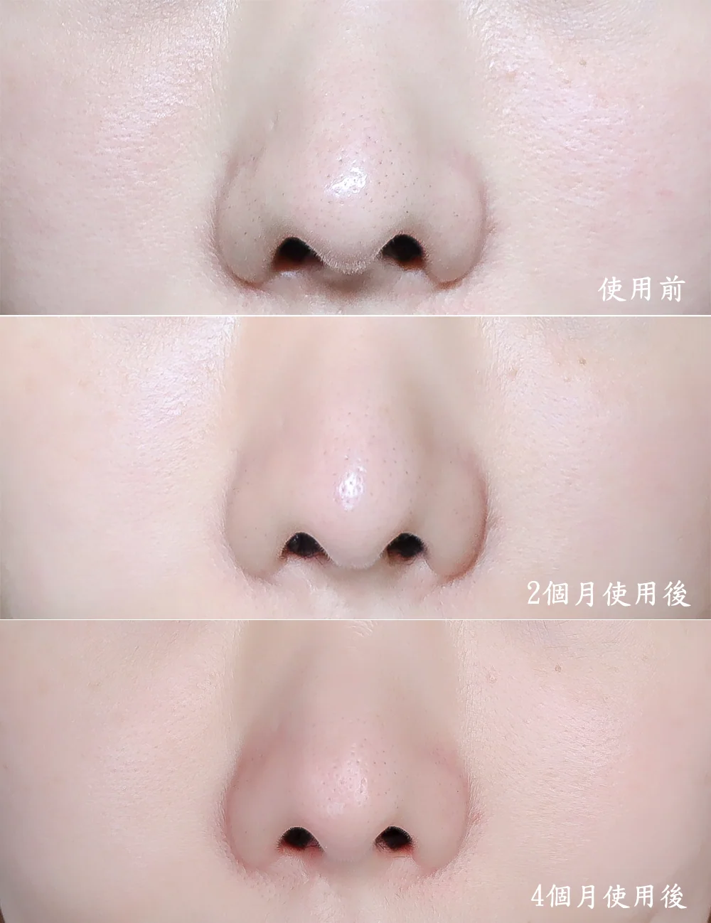 [團購美容儀] 11/19~12/19 Ulike 白皇后來了！🔥 黑卡級護膚神器，讓你素顏比化妝還美！限時團購中！(獎)（照片 38）