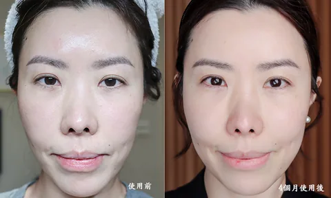 [團購美容儀] 11/19~12/19 Ulike 白皇后來了！🔥 黑卡級護膚神器，讓你素顏比化妝還美！限時團購中！(獎)（照片 56）