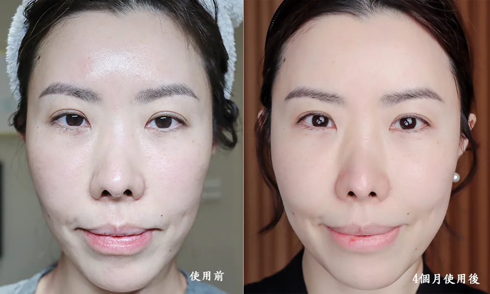 [團購美容儀] 11/19~12/19 Ulike 白皇后來了！🔥 黑卡級護膚神器，讓你素顏比化妝還美！限時團購中！(獎)（照片 56）