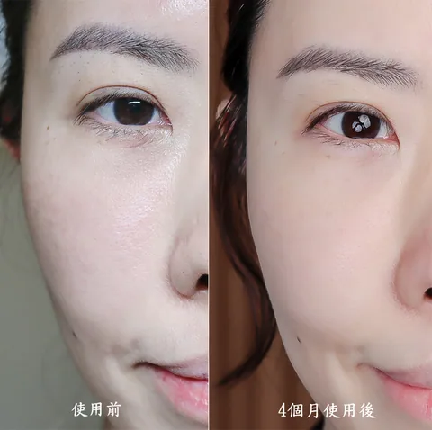 [團購美容儀] 11/19~12/19 Ulike 白皇后來了！🔥 黑卡級護膚神器，讓你素顏比化妝還美！限時團購中！(獎)（照片 57）