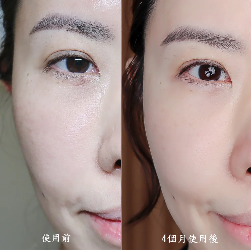 [團購美容儀] 11/19~12/19 Ulike 白皇后來了！🔥 黑卡級護膚神器，讓你素顏比化妝還美！限時團購中！(獎)（照片 57）