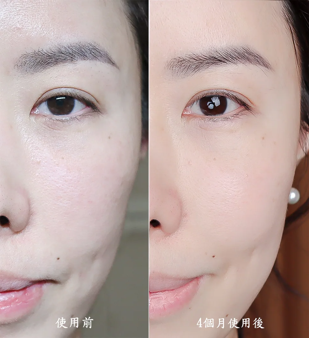 [團購美容儀] 11/19~12/19 Ulike 白皇后來了！🔥 黑卡級護膚神器，讓你素顏比化妝還美！限時團購中！(獎)（照片 58）