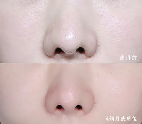 [團購美容儀] 11/19~12/19 Ulike 白皇后來了！🔥 黑卡級護膚神器，讓你素顏比化妝還美！限時團購中！(獎)（照片 59）