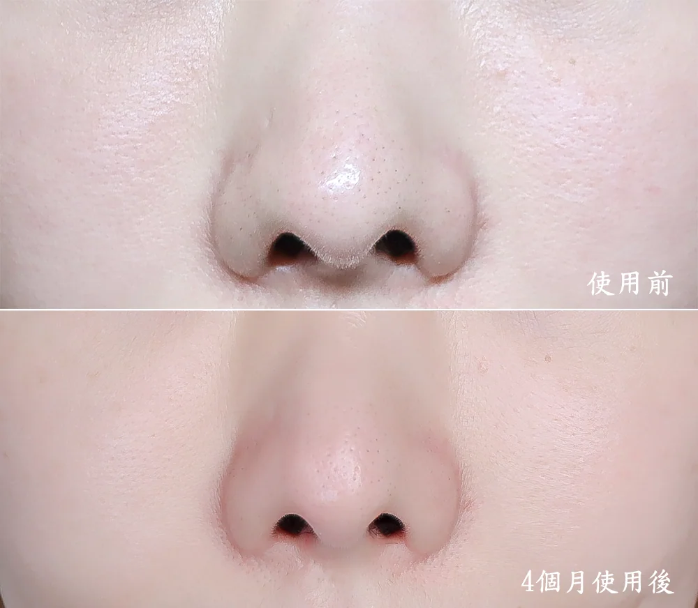 [團購美容儀] 11/19~12/19 Ulike 白皇后來了！🔥 黑卡級護膚神器，讓你素顏比化妝還美！限時團購中！(獎)（照片 59）