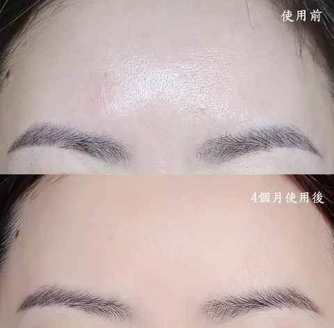 [團購美容儀] 11/19~12/19 Ulike 白皇后來了！🔥 黑卡級護膚神器，讓你素顏比化妝還美！限時團購中！(獎)（照片 60）