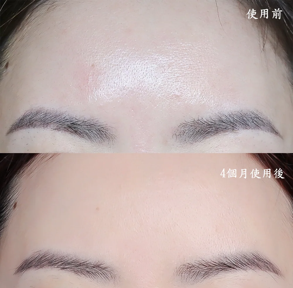 [團購美容儀] 11/19~12/19 Ulike 白皇后來了！🔥 黑卡級護膚神器，讓你素顏比化妝還美！限時團購中！(獎)（照片 60）